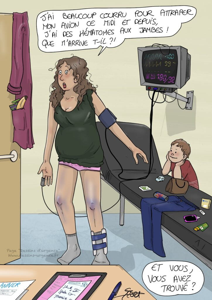 Dame paniquée avec les jambes bleues