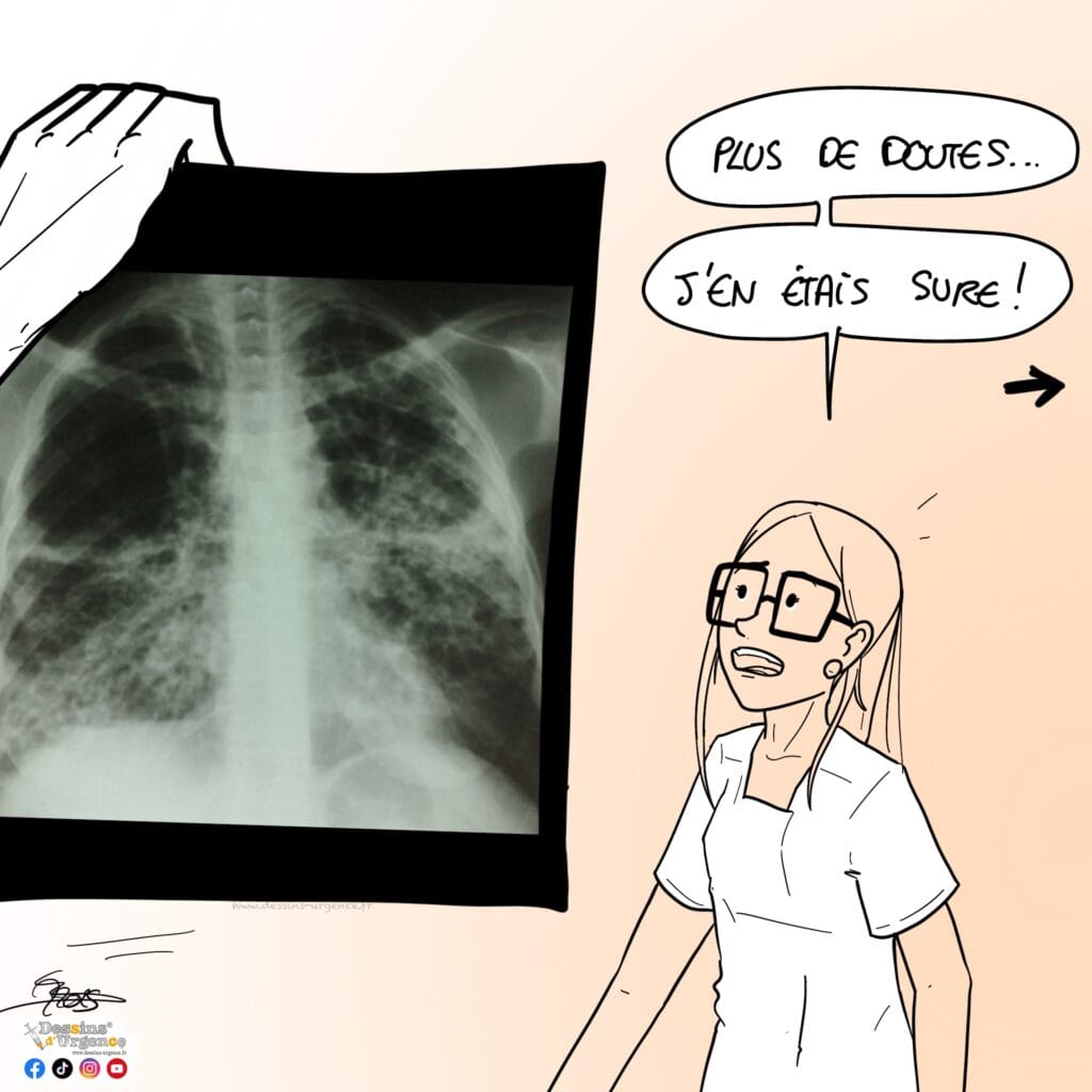 radio thorax