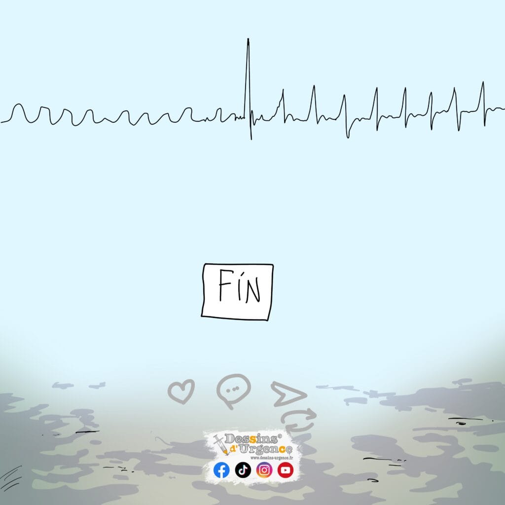 éléctrocardiogramme